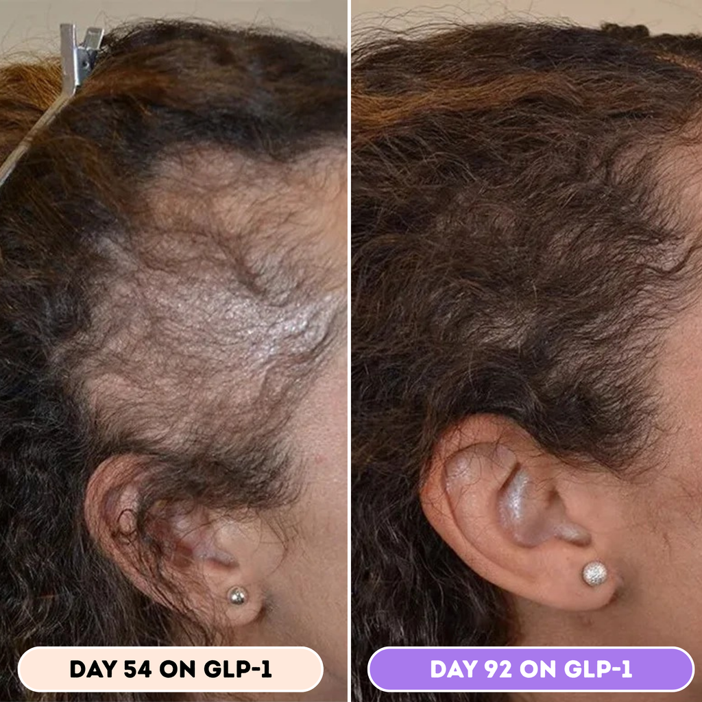 Husha® Natural Hair Growth Spray