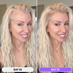 Husha® Natural Hair Growth Spray