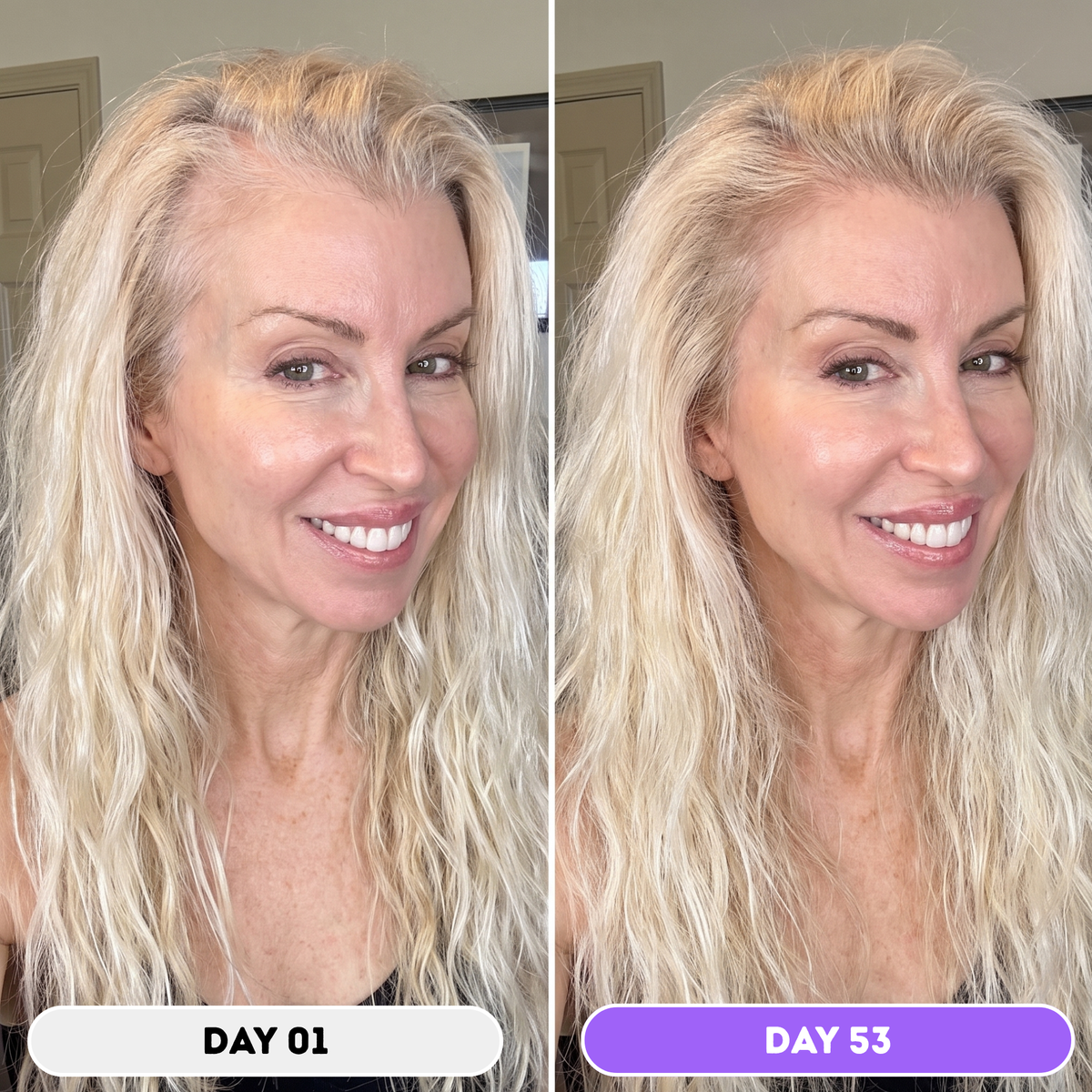 Husha® Natural Hair Growth Spray