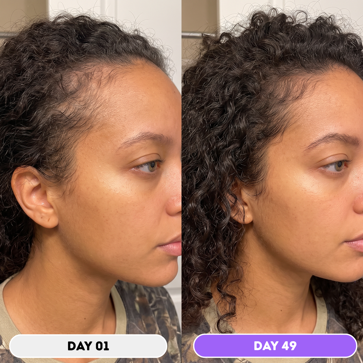 Husha® Natural Hair Growth Spray