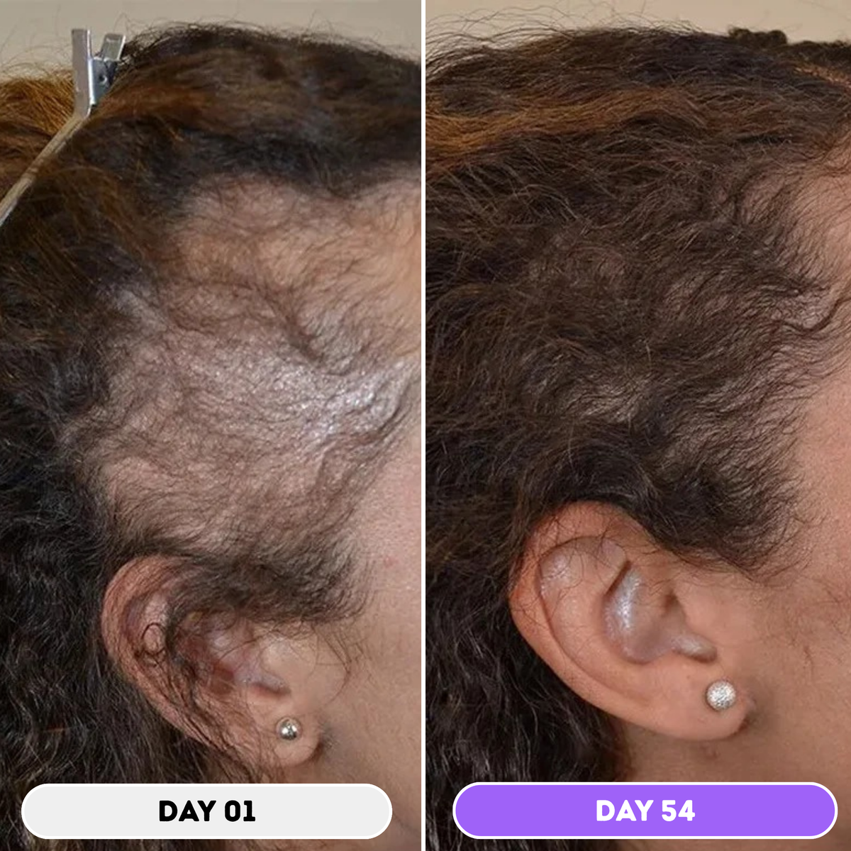 Husha® Natural Hair Growth Spray
